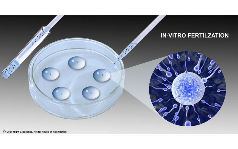 體外受精技術平臺